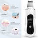 Скрабер для ультразвуковой чистки лица с 4 режимами Ultrasonic Blackhead PC03 scraber-blackhead фото 3